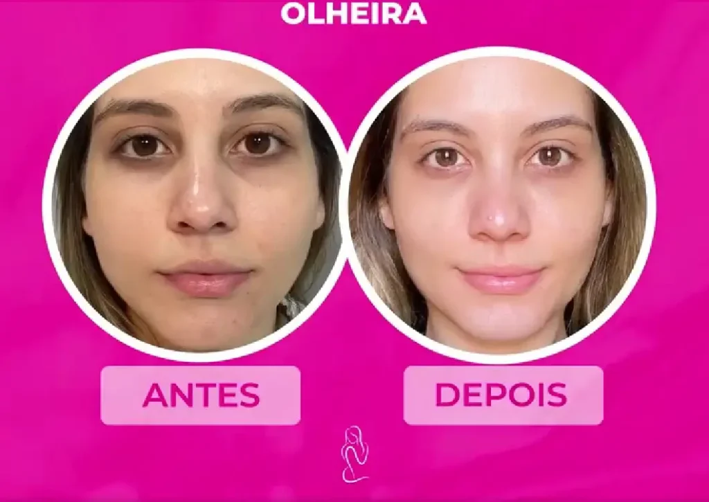 provasocial1