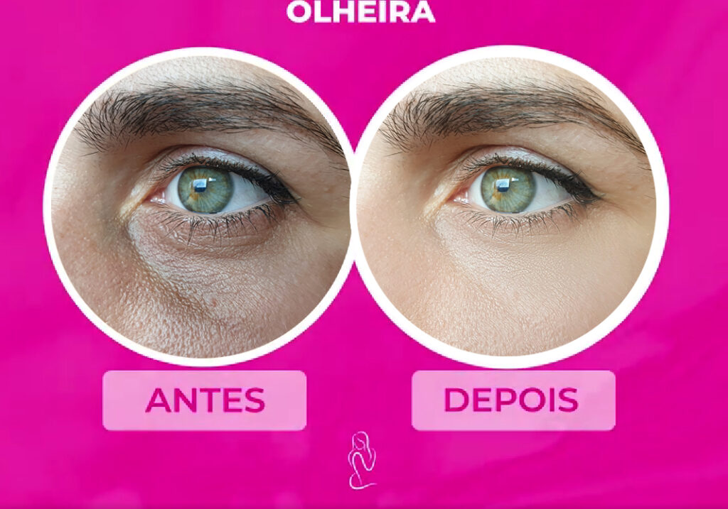 olheira1