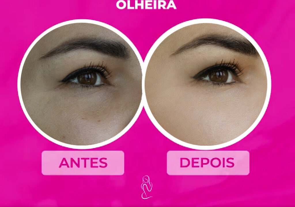 olheira2